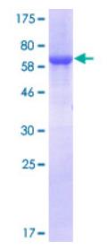SDS-PAGE (GALT-4714H).jpg